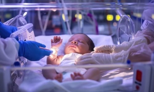 On-site NICU for the care of premature or critically ill infants